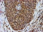 PSMB9 Antibody in Immunohistochemistry (Paraffin) (IHC (P))