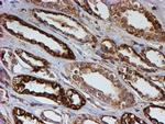 PSMB9 Antibody in Immunohistochemistry (Paraffin) (IHC (P))