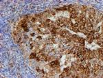 PSMB9 Antibody in Immunohistochemistry (Paraffin) (IHC (P))