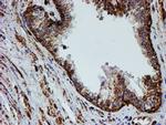 PSMB9 Antibody in Immunohistochemistry (Paraffin) (IHC (P))