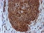 PSMB9 Antibody in Immunohistochemistry (Paraffin) (IHC (P))