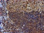 PSMB9 Antibody in Immunohistochemistry (Paraffin) (IHC (P))