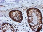 PSMB9 Antibody in Immunohistochemistry (Paraffin) (IHC (P))