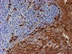 PSMB9 Antibody in Immunohistochemistry (Paraffin) (IHC (P))