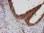 PSMB9 Antibody in Immunohistochemistry (Paraffin) (IHC (P))