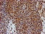 PSMB9 Antibody in Immunohistochemistry (Paraffin) (IHC (P))