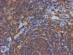 PSMB9 Antibody in Immunohistochemistry (Paraffin) (IHC (P))