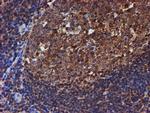 PSMB9 Antibody in Immunohistochemistry (Paraffin) (IHC (P))