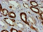 PSMB9 Antibody in Immunohistochemistry (Paraffin) (IHC (P))