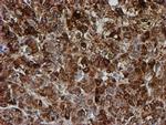 PSMB9 Antibody in Immunohistochemistry (Paraffin) (IHC (P))