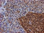 PSMB9 Antibody in Immunohistochemistry (Paraffin) (IHC (P))