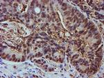 PSMB9 Antibody in Immunohistochemistry (Paraffin) (IHC (P))