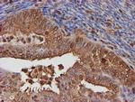 PSMB9 Antibody in Immunohistochemistry (Paraffin) (IHC (P))