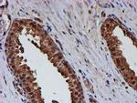 PSMB9 Antibody in Immunohistochemistry (Paraffin) (IHC (P))