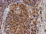 PSMB9 Antibody in Immunohistochemistry (Paraffin) (IHC (P))