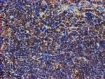 PSMB9 Antibody in Immunohistochemistry (Paraffin) (IHC (P))