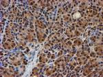 PSMB9 Antibody in Immunohistochemistry (Paraffin) (IHC (P))