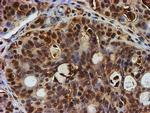 PSMB9 Antibody in Immunohistochemistry (Paraffin) (IHC (P))