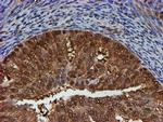 PSMB9 Antibody in Immunohistochemistry (Paraffin) (IHC (P))