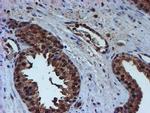 PSMB9 Antibody in Immunohistochemistry (Paraffin) (IHC (P))