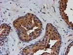 PSMB9 Antibody in Immunohistochemistry (Paraffin) (IHC (P))