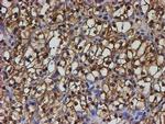 PSMB9 Antibody in Immunohistochemistry (Paraffin) (IHC (P))