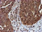 PSMB9 Antibody in Immunohistochemistry (Paraffin) (IHC (P))