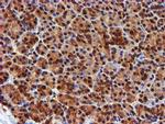 PSMB9 Antibody in Immunohistochemistry (Paraffin) (IHC (P))