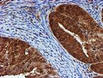 PSMB9 Antibody in Immunohistochemistry (Paraffin) (IHC (P))