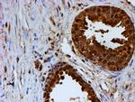 PSMB9 Antibody in Immunohistochemistry (Paraffin) (IHC (P))