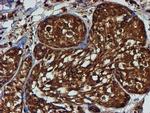 PSMB9 Antibody in Immunohistochemistry (Paraffin) (IHC (P))