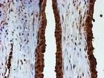 PSMB9 Antibody in Immunohistochemistry (Paraffin) (IHC (P))