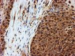 PSMB9 Antibody in Immunohistochemistry (Paraffin) (IHC (P))