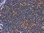 PSMB9 Antibody in Immunohistochemistry (Paraffin) (IHC (P))