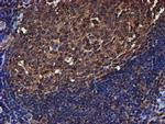 PSMB9 Antibody in Immunohistochemistry (Paraffin) (IHC (P))