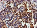 PSMB9 Antibody in Immunohistochemistry (Paraffin) (IHC (P))