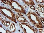 PSMB9 Antibody in Immunohistochemistry (Paraffin) (IHC (P))