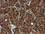 PSMB9 Antibody in Immunohistochemistry (Paraffin) (IHC (P))