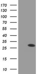 PSMB9 Antibody in Western Blot (WB)