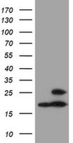 PSMB9 Antibody in Western Blot (WB)