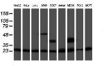 PSMB9 Antibody in Western Blot (WB)