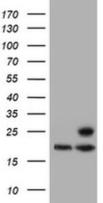 PSMB9 Antibody in Western Blot (WB)