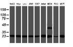 PSMB9 Antibody in Western Blot (WB)