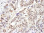 PSMC1 Antibody in Immunohistochemistry (IHC)