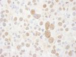 PSMC2 Antibody in Immunohistochemistry (IHC)