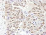 PSMC2 Antibody in Immunohistochemistry (IHC)