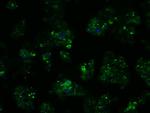 PSMC3 Antibody in Immunocytochemistry (ICC/IF)