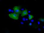 PSMC3 Antibody in Immunocytochemistry (ICC/IF)