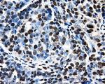 PSMC3 Antibody in Immunohistochemistry (Paraffin) (IHC (P))