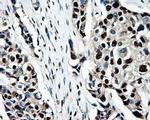 PSMC3 Antibody in Immunohistochemistry (Paraffin) (IHC (P))